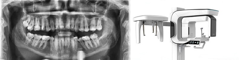 rentgen zębów nowy sącz